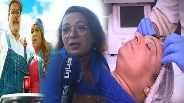 بشرى أهريش: ها الحقيقة ديال عملية التجميل اللي درت