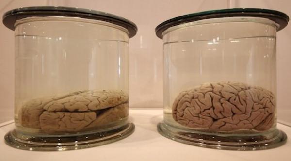 علماء ألمان يزرعون أدمغة بشرية صغيرة لأغراض علمية