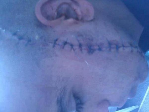 انفلات أمني خطير بالفنيدق و اتهام لرجال الأمن بالتقصير   !!