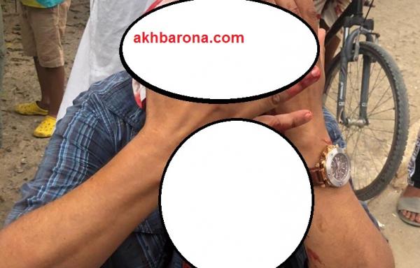 اعتداء "بلطجي" على مواطن يهز هذه المدينة والمعتدي حر طليق وهذا ما وقع(الصورة)