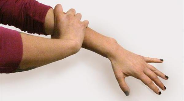  إذا استمر الوجع فترة طويلة من غير المحتمل ارتباطه بالقلب 