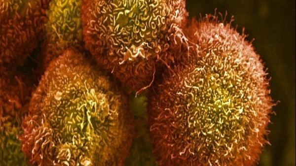 مايكروسوفت تعد بالقضاء على السرطان في 10 سنوات