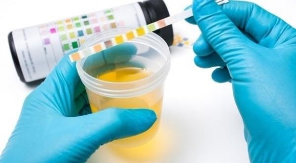 دراسة: اختبار بول بسيط يتنبأ بمدى شيخوخة أجسادنا