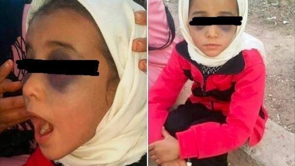 الدرك الملكي يعتقل أستاذ تارودانت المتهم بتعنيف تلميذته وغموض كبير يلف القضية