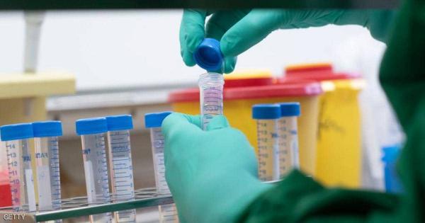 أوروبا تدخل السباق بقوة.. 4 علاجات لكورونا دفعة واحدة