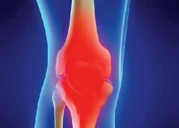 انخفاض مستوى هرمون «التستيرون» يزيد فرص التهاب المفاصل