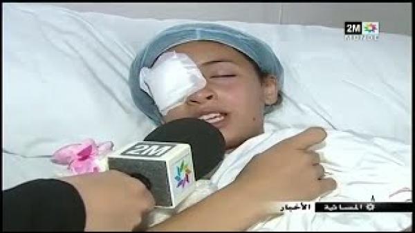 تفقد عينيها بسبب مفرقعات الالعاب النارية عاشوراء