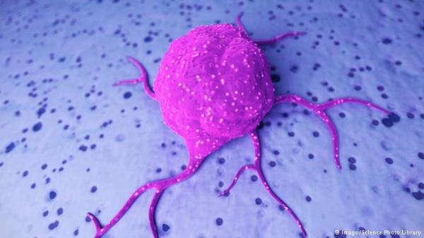 تفاقم معدلات سرطان القولون والمستقيم بين الشباب بأمريكا