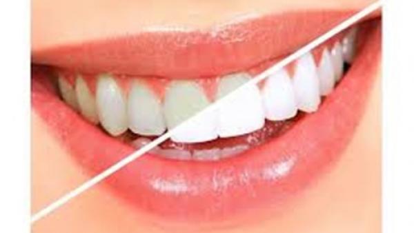 وصفة طبيعية لتبييض الأسنان في دقيقة واحدة