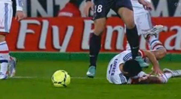 إبراهيموفيتش يدوس على رأس اللاعب ديان لوفرين