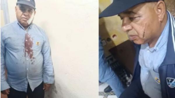 مادير خير مايطرا باس.."ساعي بريد" بفاس تدخل لفض نزاع فتلقى طعنة في وجهه!