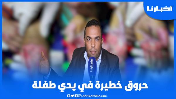 حقوقي يكشف تفاصيل ستصدم المغاربة عن حـروق خـطــيرة تـعرضت لها طفلة 