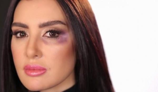 تعرض الفنانة المغربية ميساء مغربي لحادث سيارة ونقلها إلى المستشفى