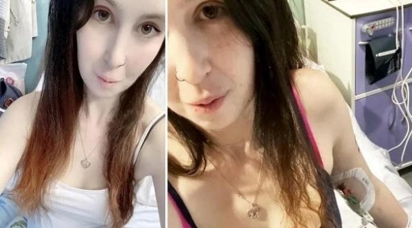 مصابة بالسرطان تضحي بساقها وتستغني عن العلاج الكيماوي للحفاظ على حياة جنينها