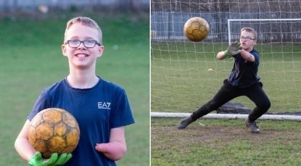 بالرغم من فقدان ساعده الأيسر.. يتحول إلى حارس مرمى شهير