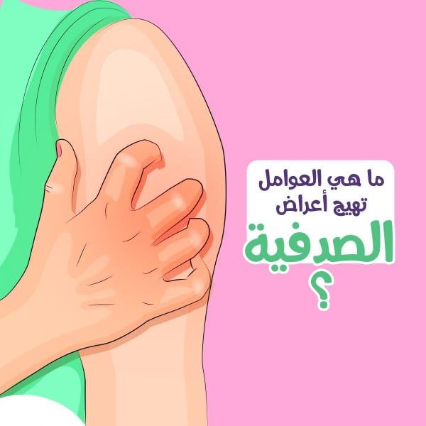 الصدفية.. مرض جلدي مزمن يتطلب علاجه الصبر والمثابرة واختيار العلاجات المناسبة