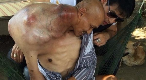 معلم تايلندي يمارس عمله رغم ورم في كتفه وزنه 10 كلغ