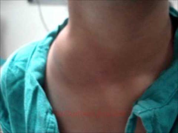 تنغير .. مرض مجهول يُصيب تلاميذ احدى المدارس و مندوبية الصحة تتدخل 