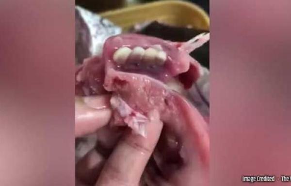 فلبينية تعثر على أسنان بشرية بسمكة الغداء!(فيديو)