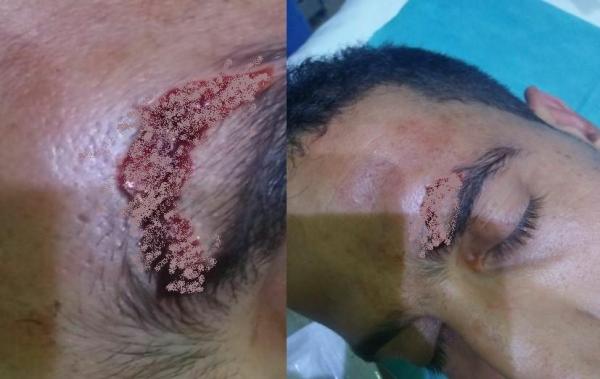 الفقيه لي نتسناو بركتو : مندوب أجراء يعتدي بشكل وحشي على عامل بوحدة فندقية