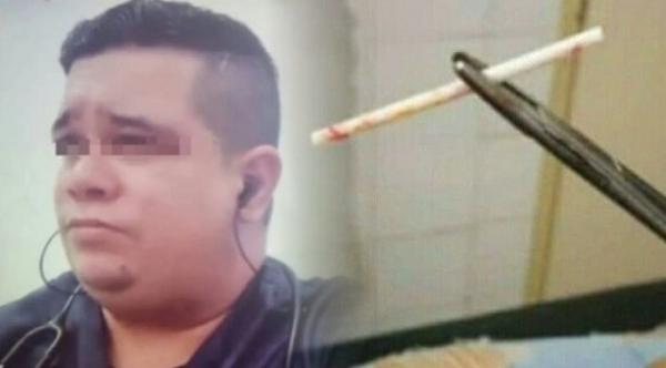 القبض على طبيب مزيف استخدم عصا مصاصة تحت الجلد كموانع حمل