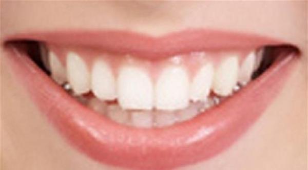 7 أشياء تخبرها أسنانك عن صحتك