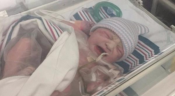 طفلة تولد وأحشاؤها خارج جسدها