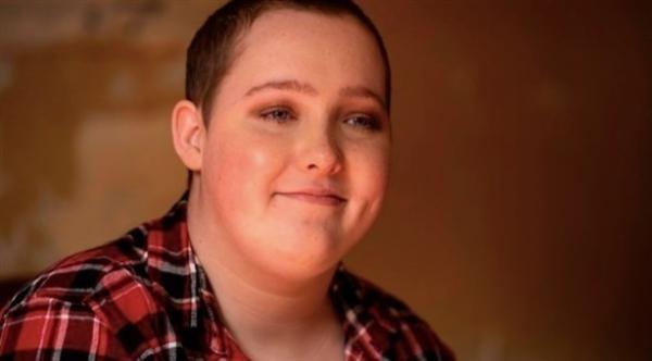 اضطراب صحّي نادر يجعل امرأة تنتزع خصلات من شعرها