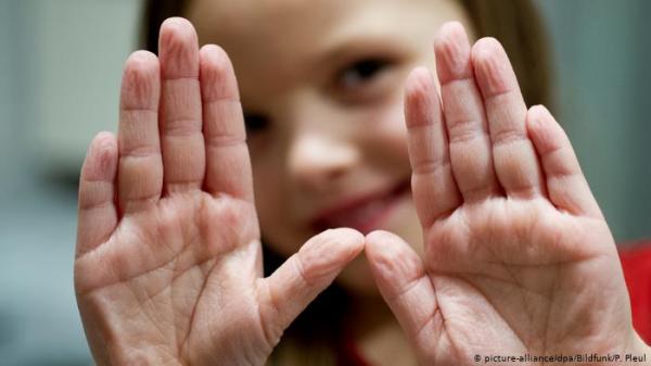 تعرف على أسباب تجعد الأصابع؟