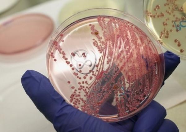 مرض خطير يجتاح إسبانيا وعدد المصابين يبلغ 195 شخص