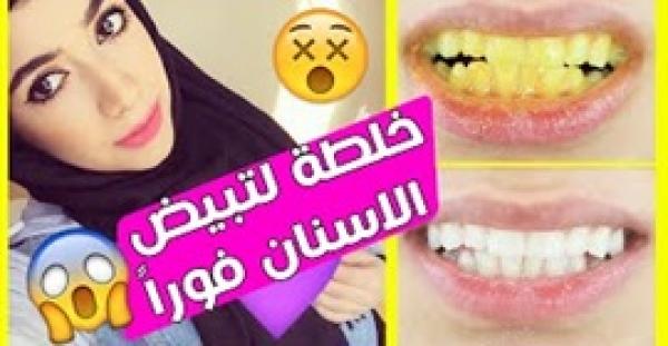 بالفيديو.. أفضل وأسهل طريقة لتبييض الأسنان