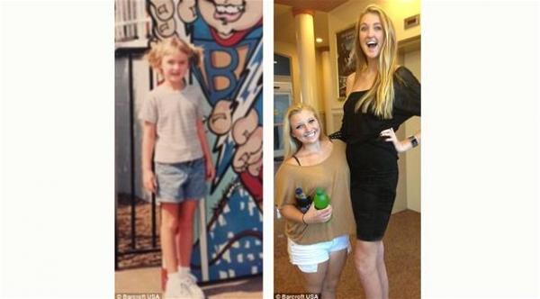 عشرينية طول ساقيها 1.26 متراً تسعى لدخول غينيس