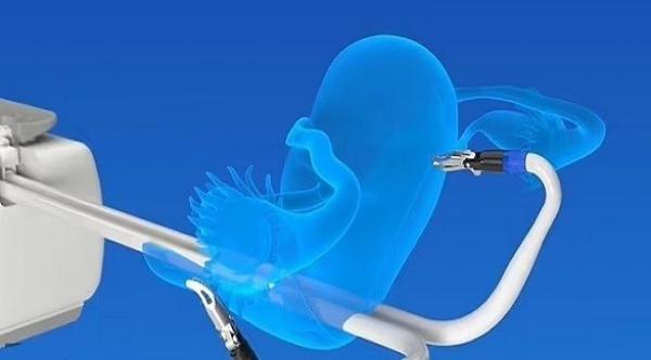 روبوت مزود بزوج من المخالب المتصلة بذراعين لإجراء عمليات استئصال الرحم