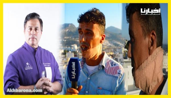 طلب من الدكتور التازي انقاذه.. شاب يتحدث عن تعرضه لإعتداء شوه وجهه وكيف أفلت من الموت بأعجوبة