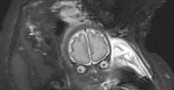 لقطات مرعبة لجنين داخل رحم أمه يشبه المخلوقات الفضائية