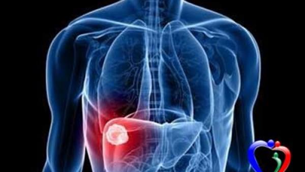 7 أعراض تكشف إصابتك بمرض كبدي صامت