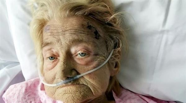 مريضة في مستشفى تتعرض للضرب حتى الموت بسبب شخيرها