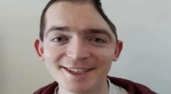 شاب يقاضي شركته بعد تعرضه لحادث شغل وفقدان جزء من رأسه