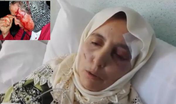 بالفيديو .. قابضة بطوبيسات القنيطرة تحكي عن تفاصيل الاعتداء الذي كاد أن يزهق روحها