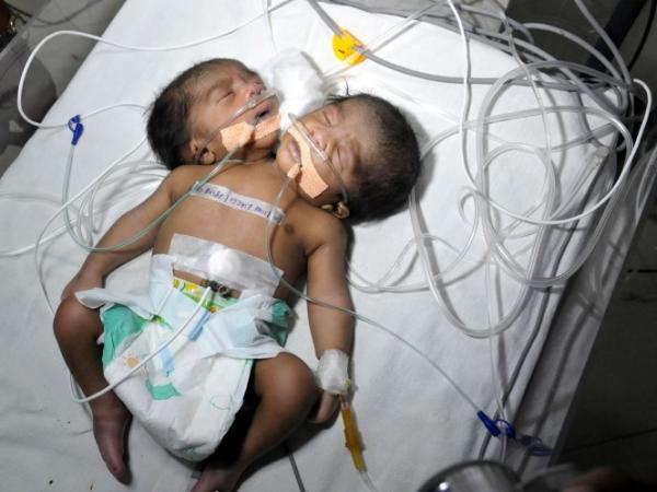 صورة للطفل من صحيفة ديلي ميل البريطانية 