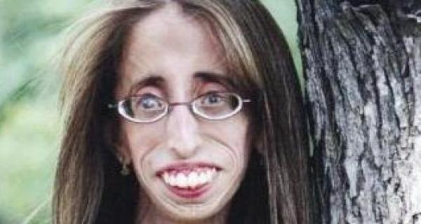 أبشع امرأة في العالم تتناول 60 وجبة يومياً وصارت ملهمة الملايين 