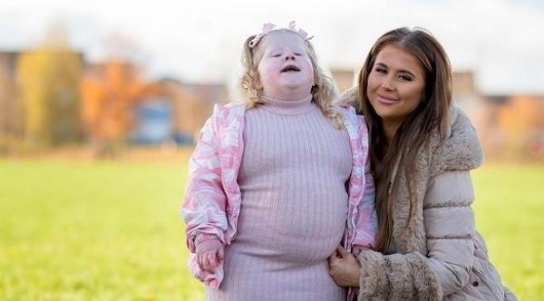 أم تلجأ  إلى منع طفلتها من دخول المطبخ بسبب حالة نادرة