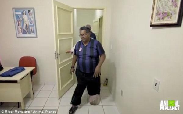 بالفيديو: برازيلي مصاب بمرض نادر يحوله إلى "فيل"