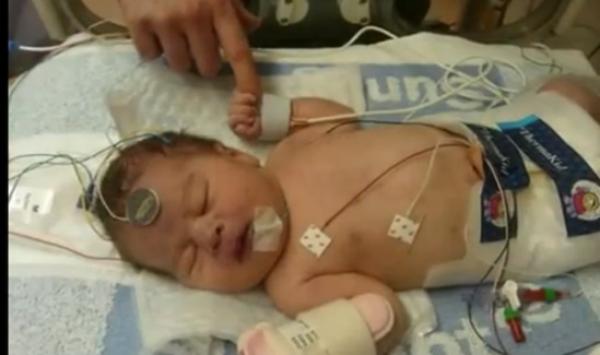 الأطباء يجمدون مولوداً 72 ساعة حفاظاً على حياته