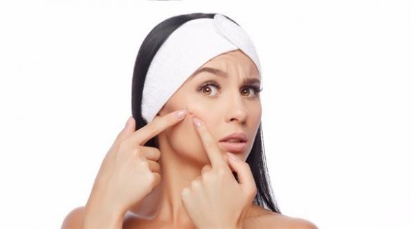 هل تعاني من حب الشباب؟ إليك الحل