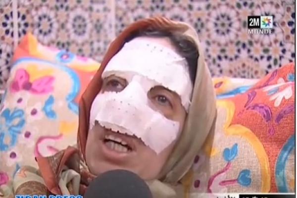 إعتداء بزجاجة على مولدة بفاس