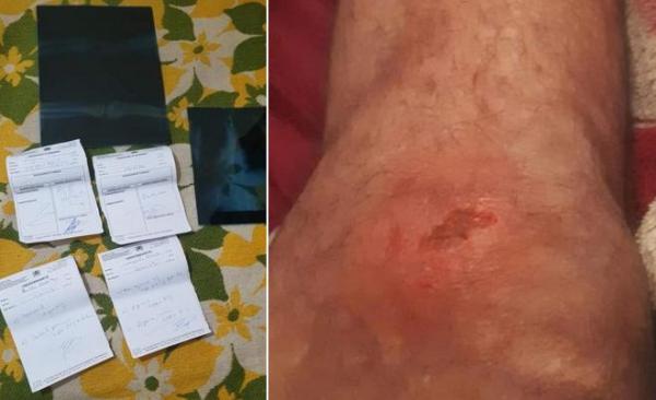 ياودي يالروح الرياضية!... مباراة لكرة القدم تنتهي ب"سلخ" لاعبين ورميهم بالحجارة ونقل المصابين للمستعجلات (صور)