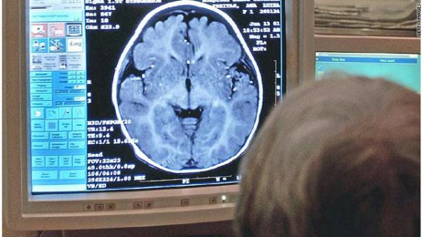 واشنطن: مبادرة بـ100 مليون دولار لفك "لغز" المخ