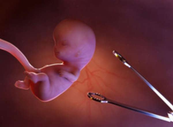 تطورات جديدة في قضية وفاة قاصر خلال خضوعها لعملية إجهاض غير شرعية ضواحي ميدلت