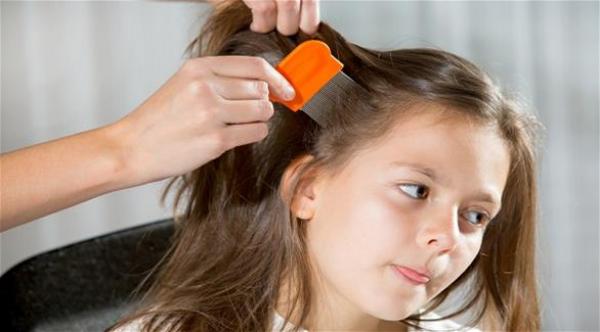 5 علاجات طبيعية للتخلص من قمل الرأس